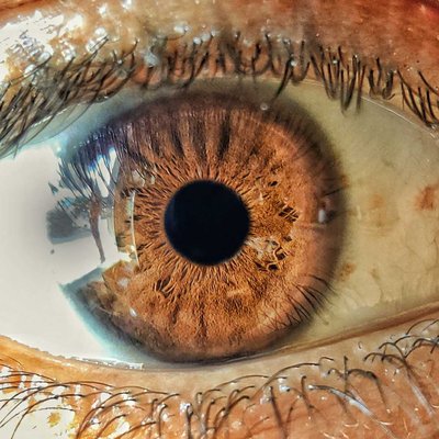 human eye