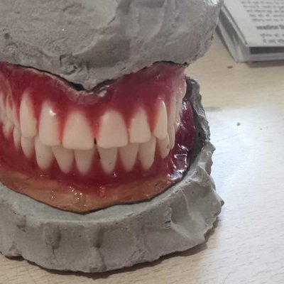 my  dental 