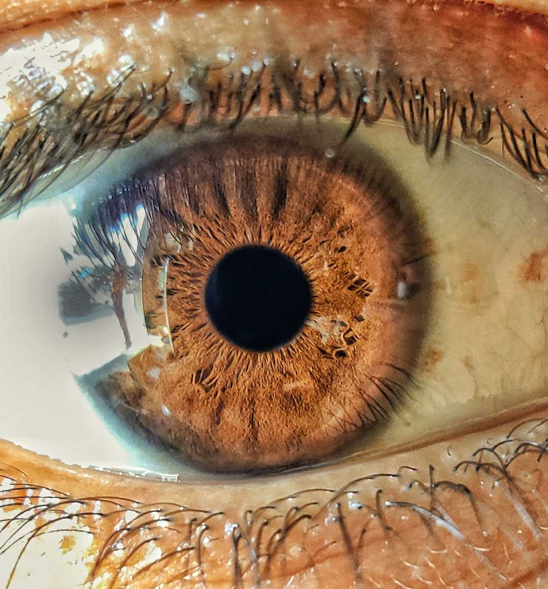 human eye