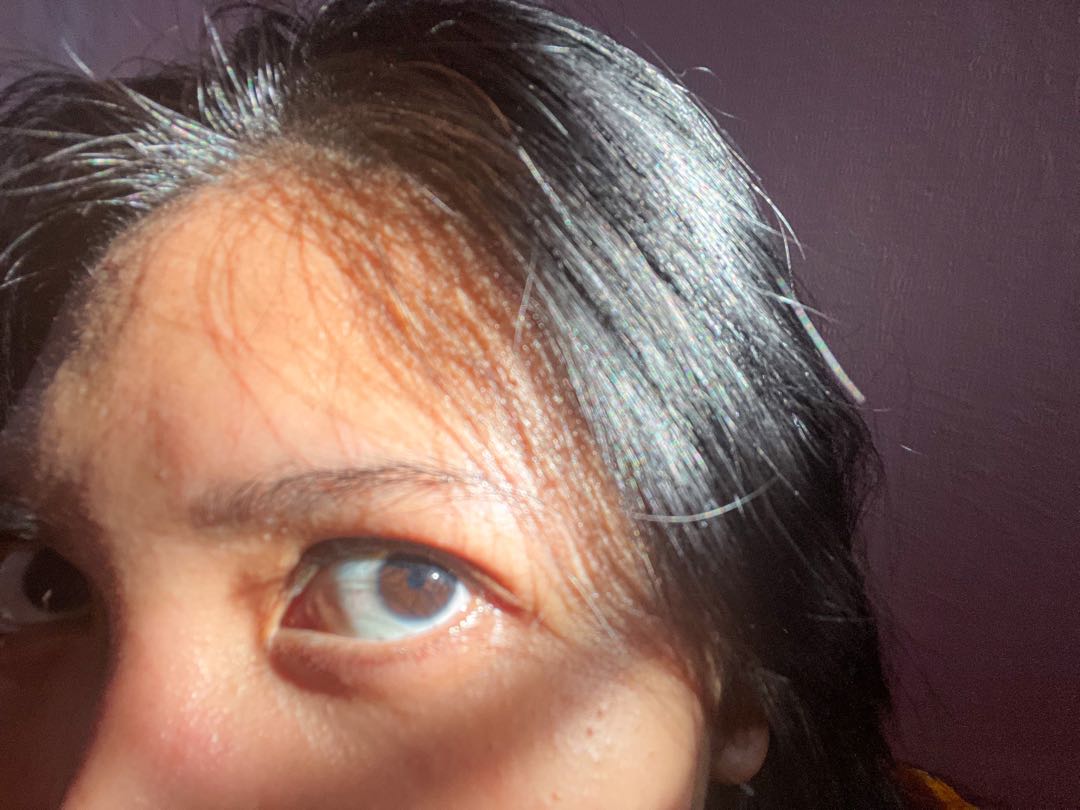 My•Eyes