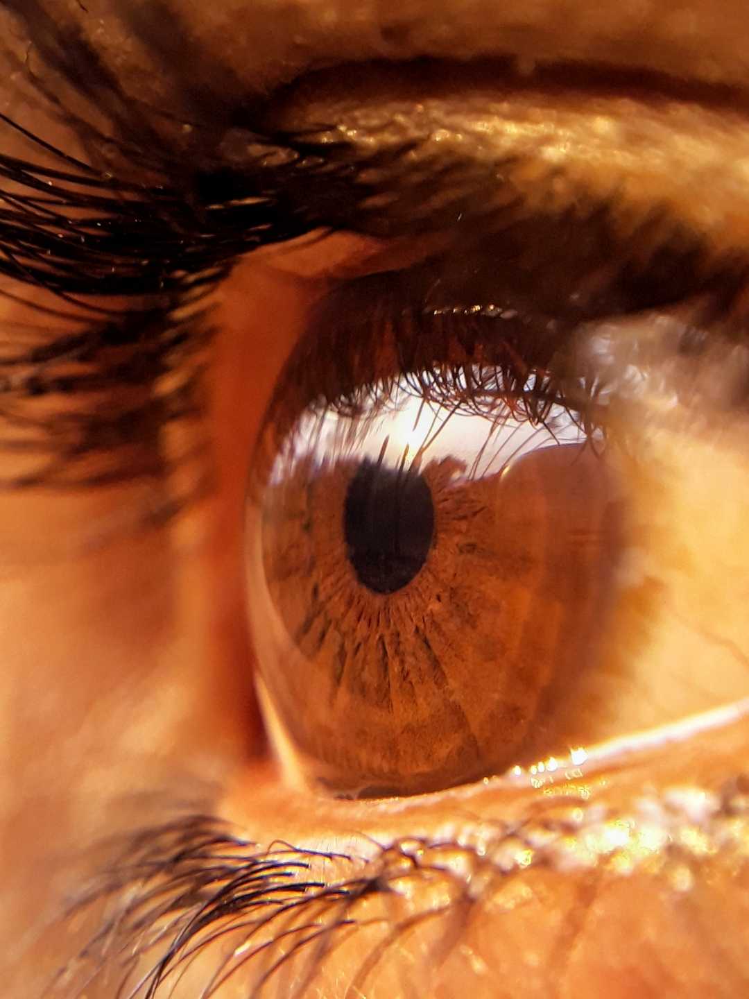 Macrophotography 
