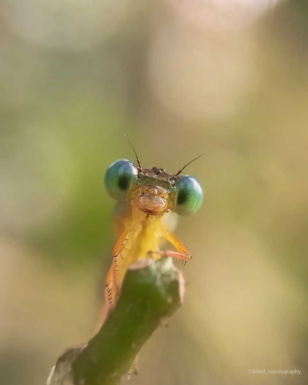Eye's
