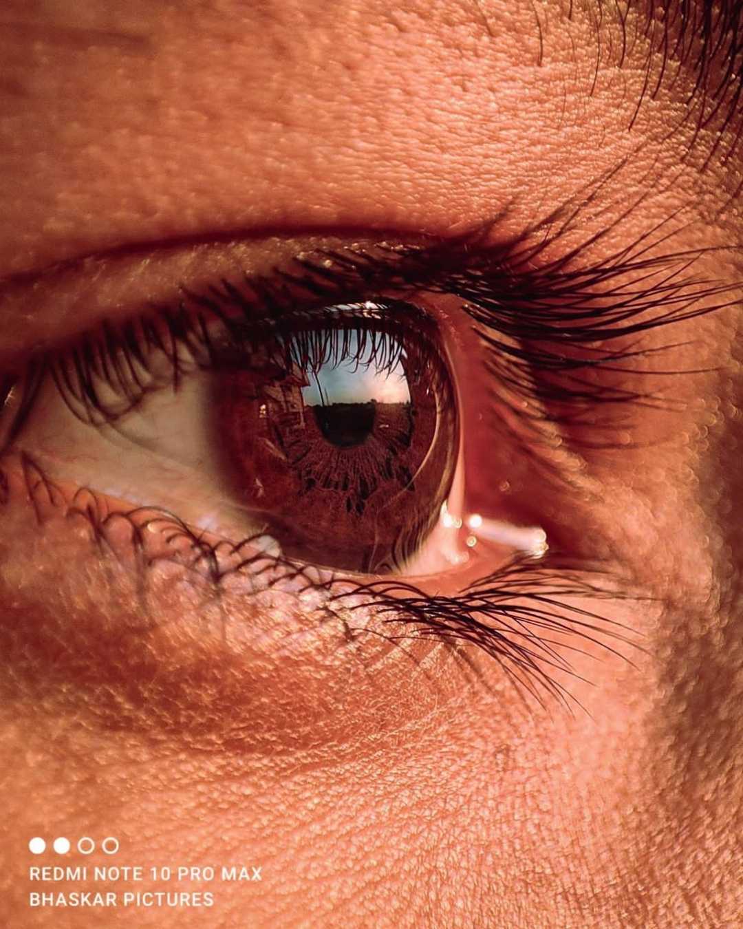 Human eye