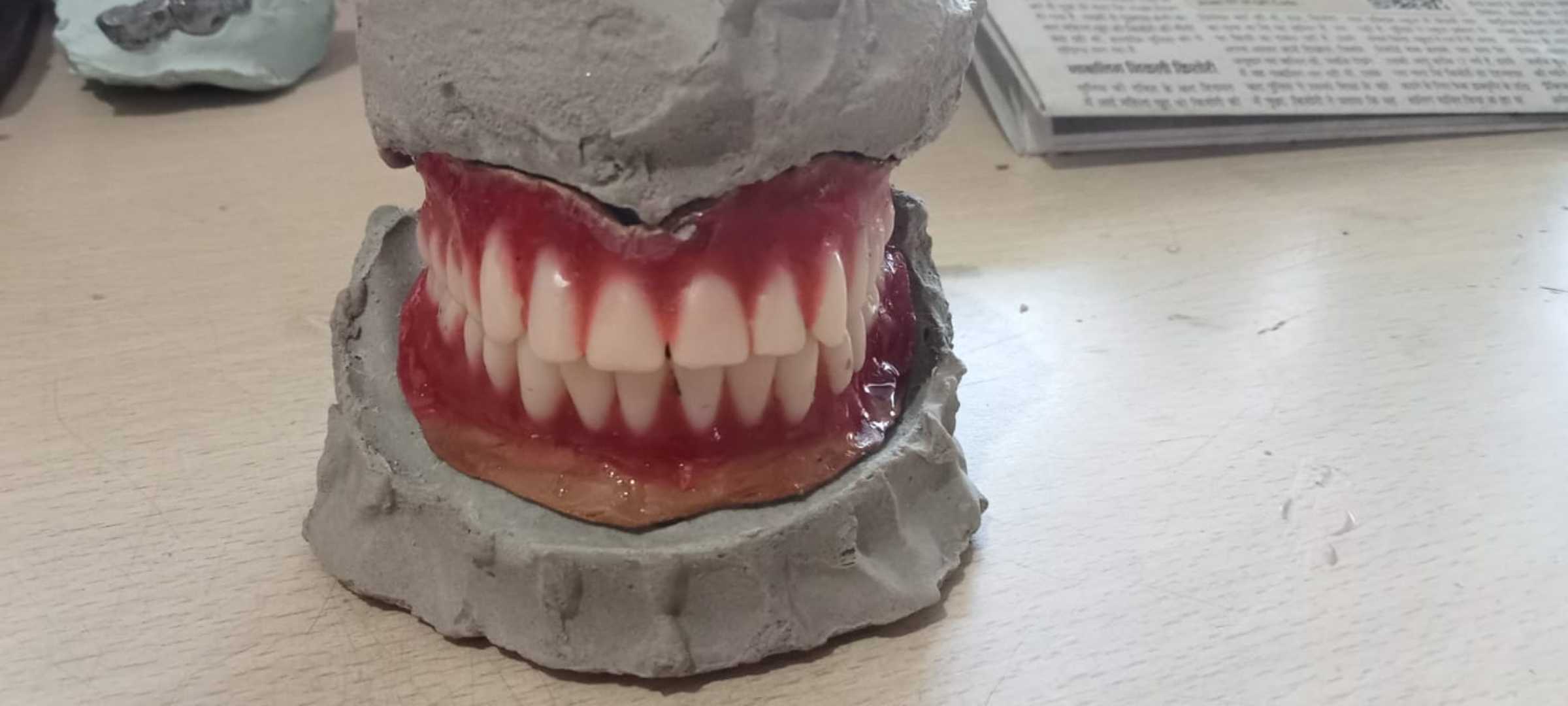my  dental 